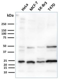 Mammaglobin A Antibody (MGB/2682R) - Azide and BSA Free, Novus Biologicals 100 &mu;g | Buy Online | Novus Biologicals | Fisher Scientific